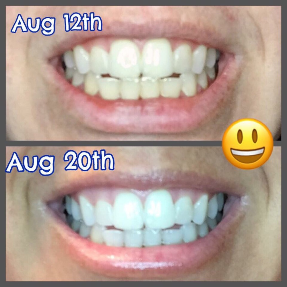 😁 AP24 Whitening Toothpaste 😁